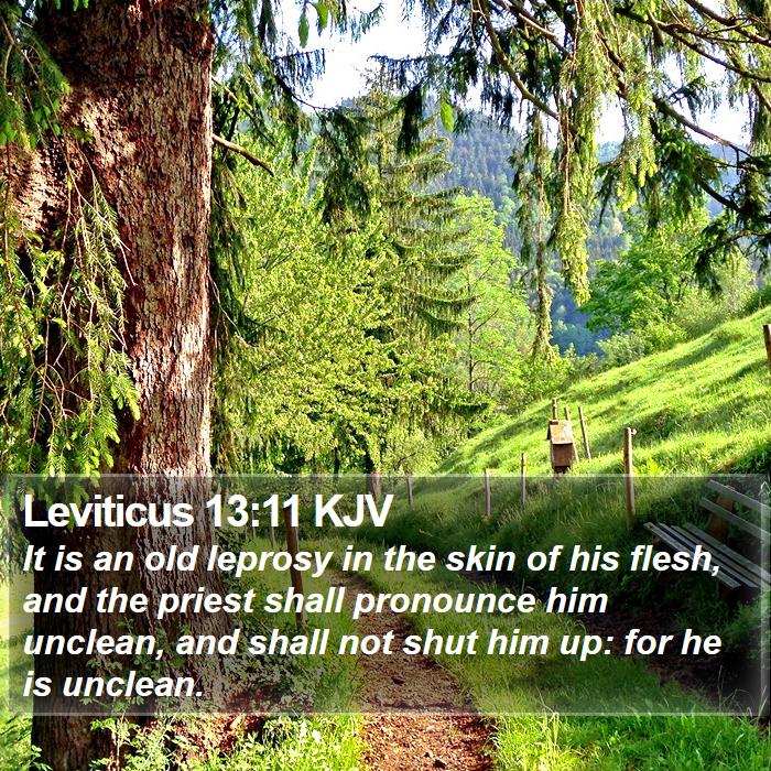 Leviticus 13:11 KJV Bible Study