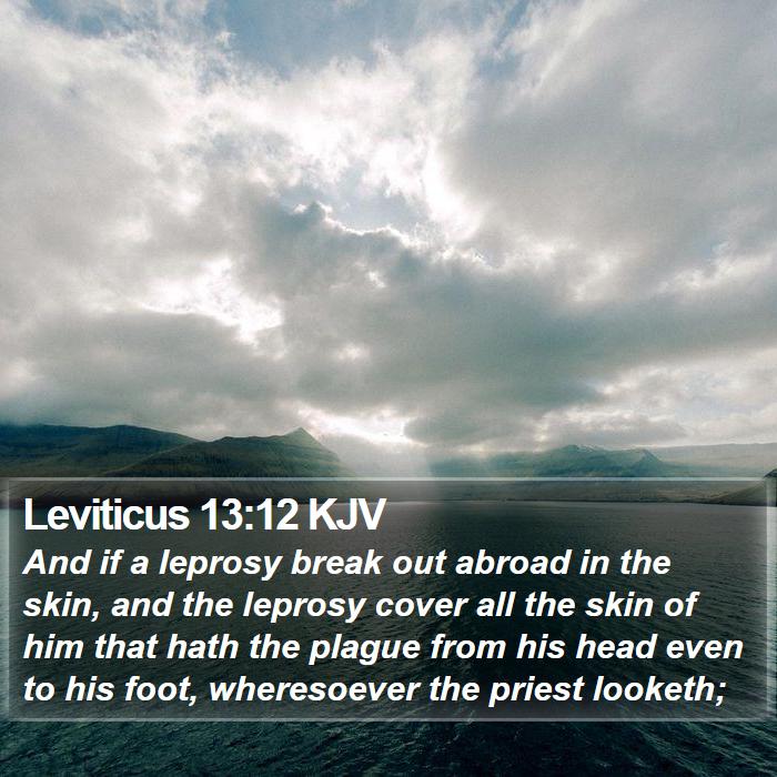 Leviticus 13:12 KJV Bible Study