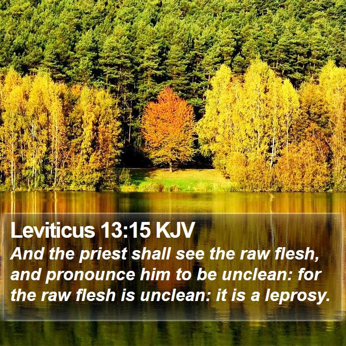 Leviticus 13:15 KJV Bible Study