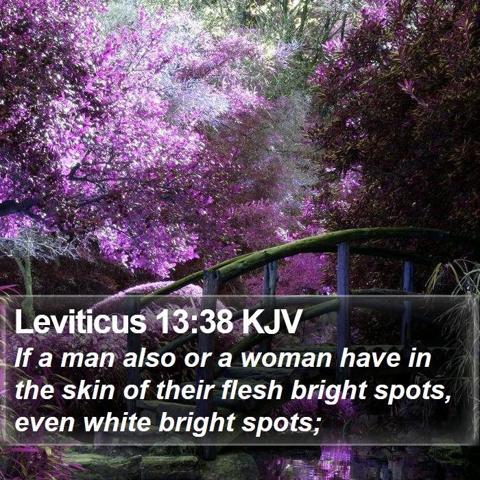 Leviticus 13:38 KJV Bible Study