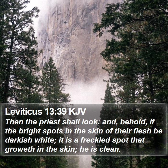 Leviticus 13:39 KJV Bible Study