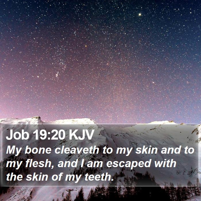 Job 19:20 KJV Bible Study