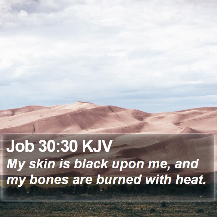 Job 30:30 KJV Bible Study