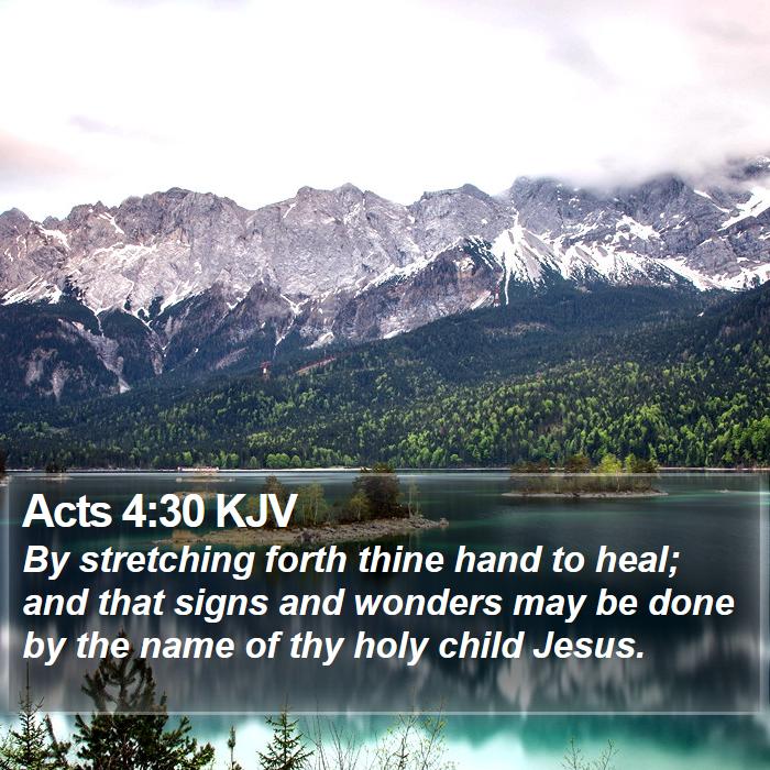 Acts 4:30 KJV Bible Study